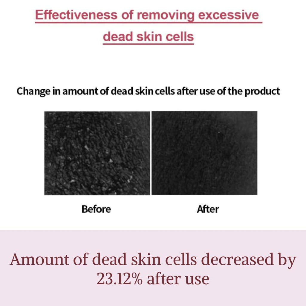 [ImFrom] Fig Boosting Essence 150ml