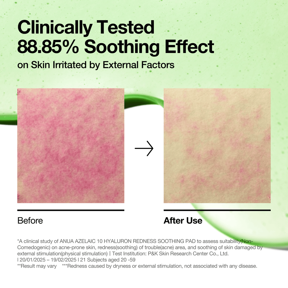 [Anua] Azelaic 10 Hyaluron Redness Soothing Pad 230ml 90ea